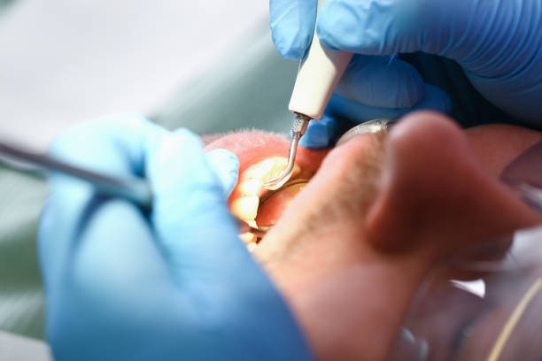 Best Mobile Emergency Dentist in Lake Geneva, WI